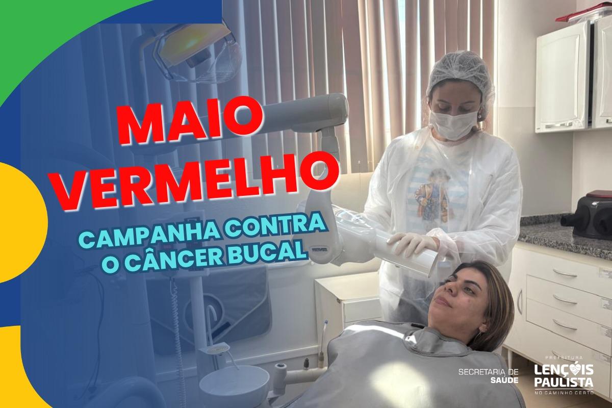 Lençóis Paulista inicia campanha Maio Vermelho com ações de prevenção ao câncer bucal