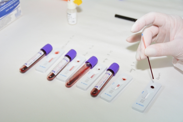 Serão aplicados mil testes na quinta etapa do Censo Covid no domingo, 13